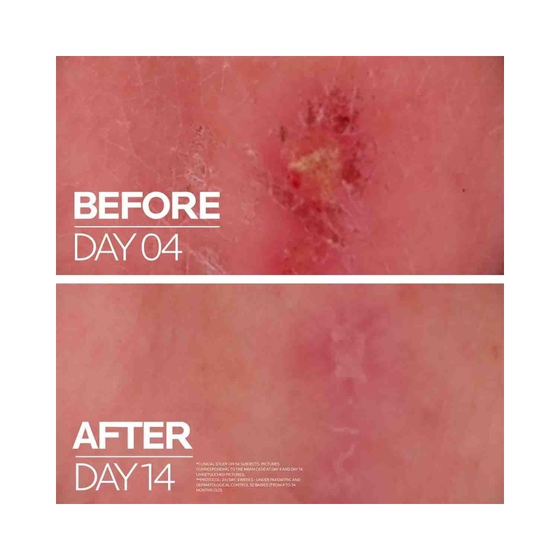 CICAPLAST BAUME B5+ 40 ml