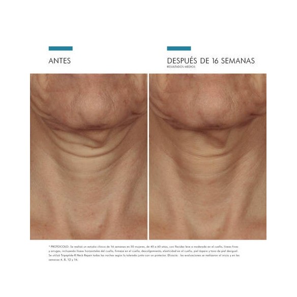 SKINCEUTICALS TRIPEPTIDE-R NECK REPAIR 50 ml